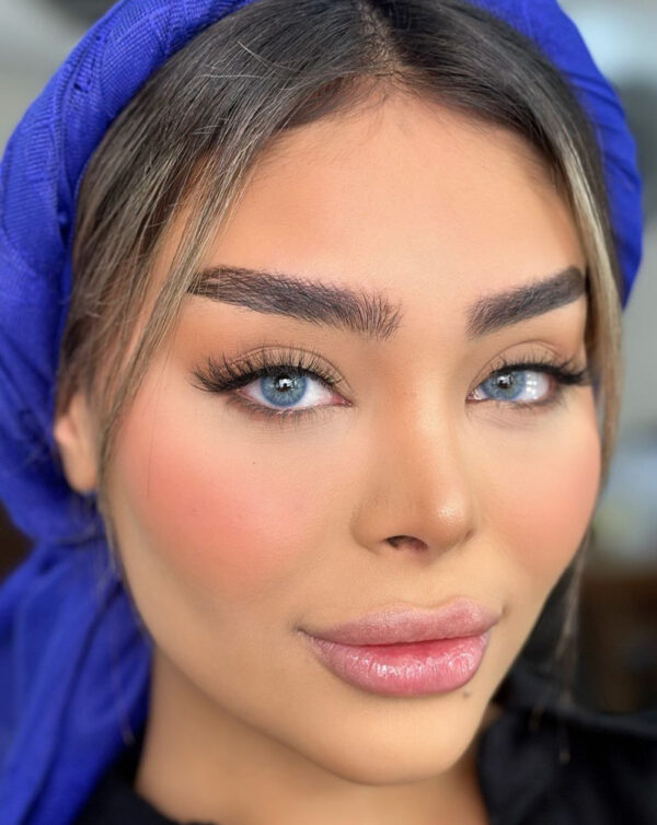 لوتوس