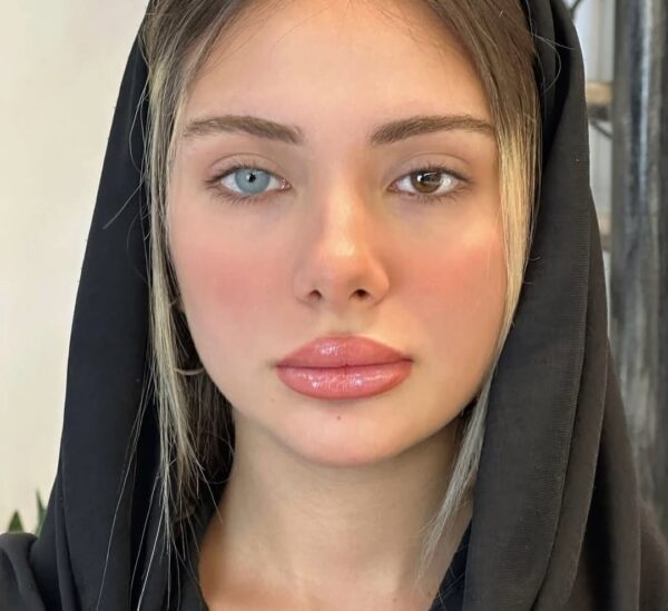 چلسی گری - تصویر 4